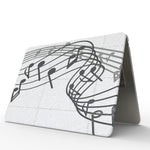 UV Printed Pattern Laptop Frosted Protective Case, For MacBook Air 11.6 A1370 / A1465, For MacBook Pro 13.3 A1278