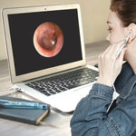 i95 3 in 1 USB Ear Scope Inspection HD 0.3MP Camera Visual Ear Spoon for OTG Android Phones & PC & MacBook, 1.75m Length Cable, 3 in 1 White  0.3MP