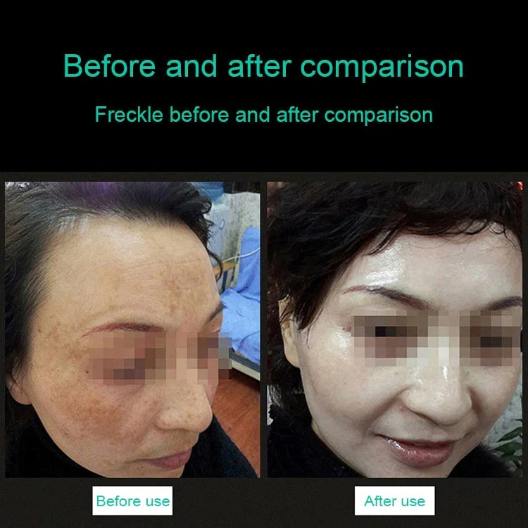 نص بديل للصورة