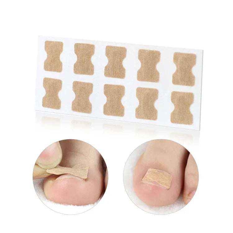 10 PCS Glue-free Orthopedic Nail Stick Toe Nail Groove Inlay Corrector, Transparent Bottom, White Bottom, Blue Bottom