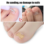 10 PCS Glue-free Orthopedic Nail Stick Toe Nail Groove Inlay Corrector, Transparent Bottom, White Bottom, Blue Bottom